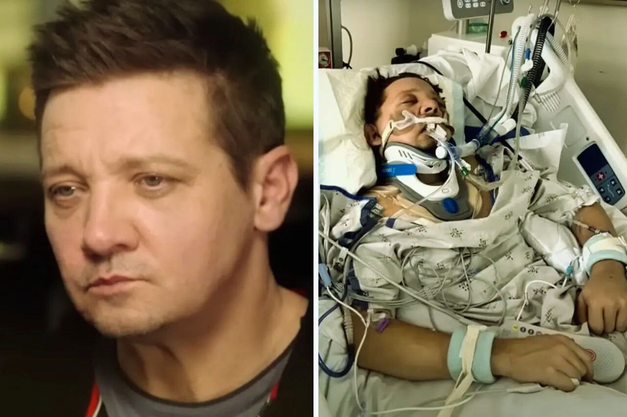 Jeremy Renner claims that during the horrifying snowplough accident that resulted in 38 broken bones, his eyeball was out.