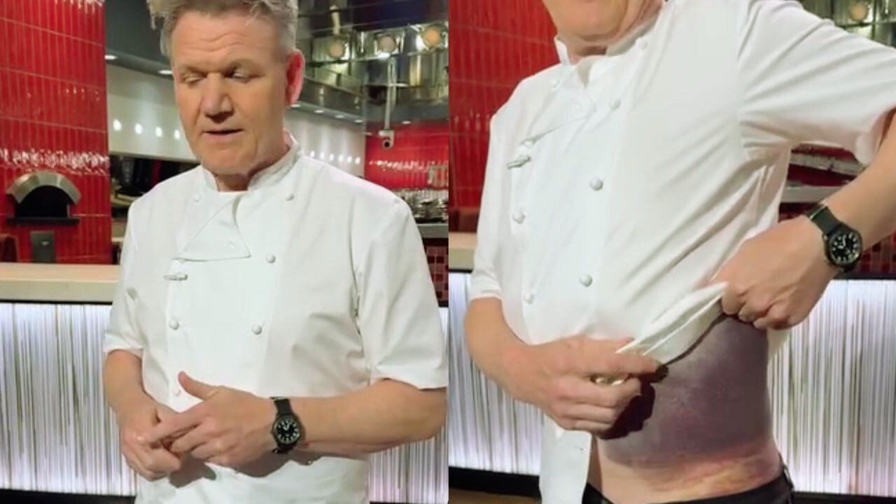 Gordon Ramsay ‘Lucky to Be Here’ After US Bike Crash